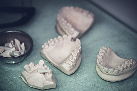 Dental prosthesis, artificial tooth. Photo of artificial teeth made in the dental laboratory.